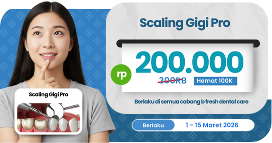 Scaling Gigi Pro + TSR